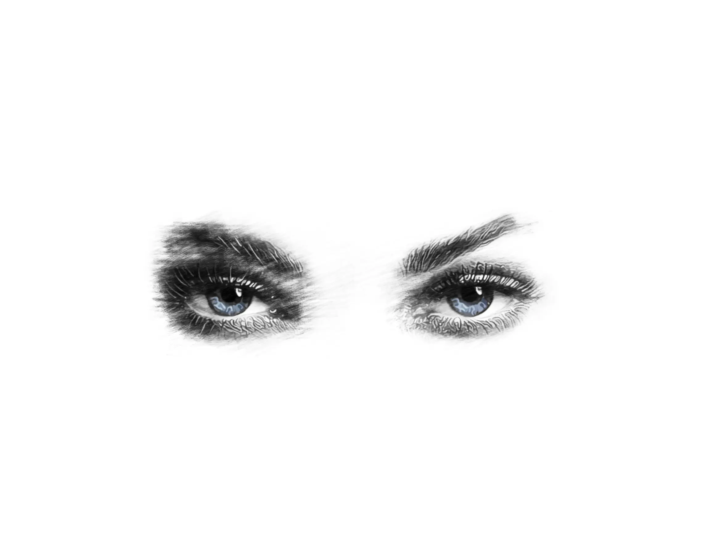 Brow lift