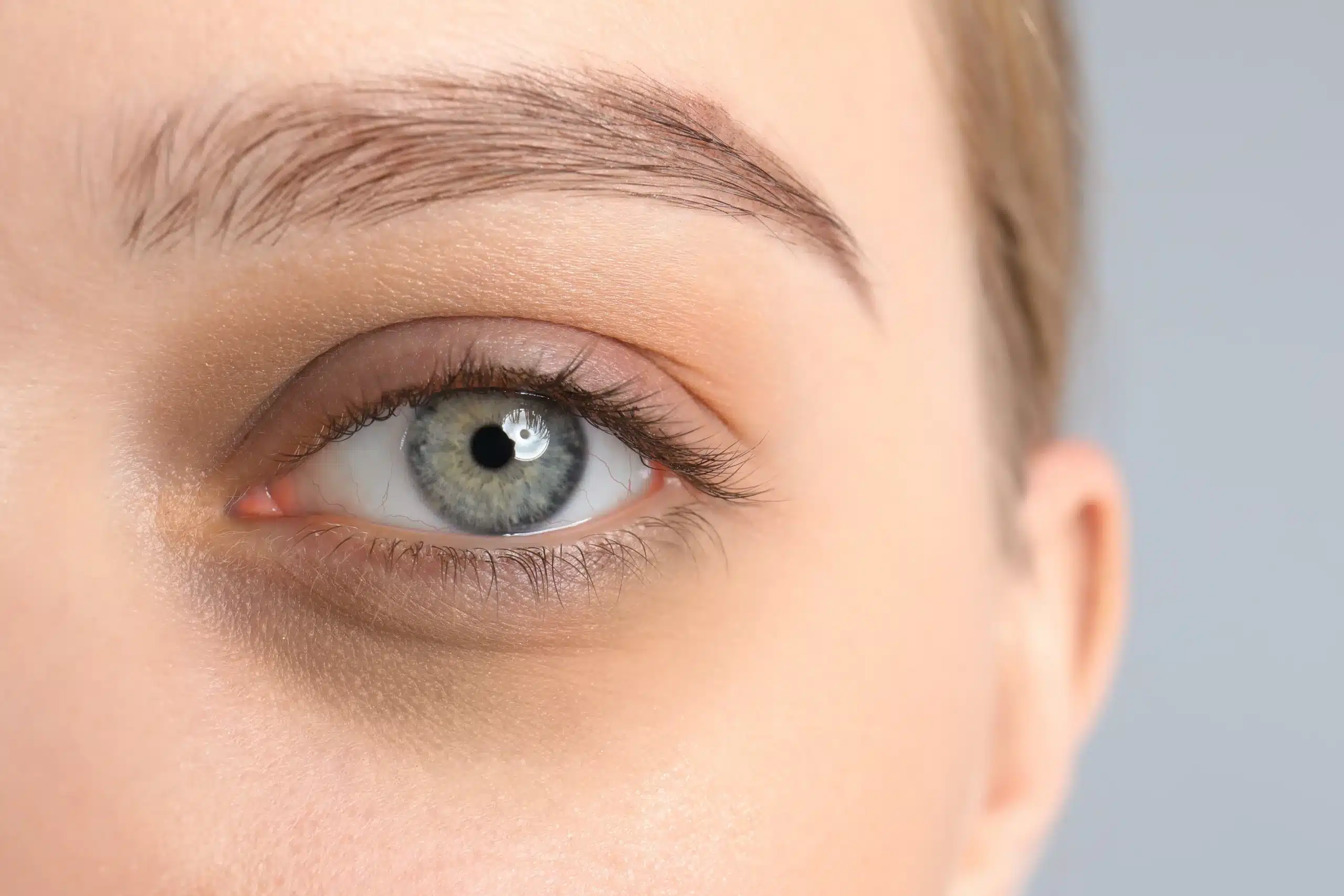 Dark circles