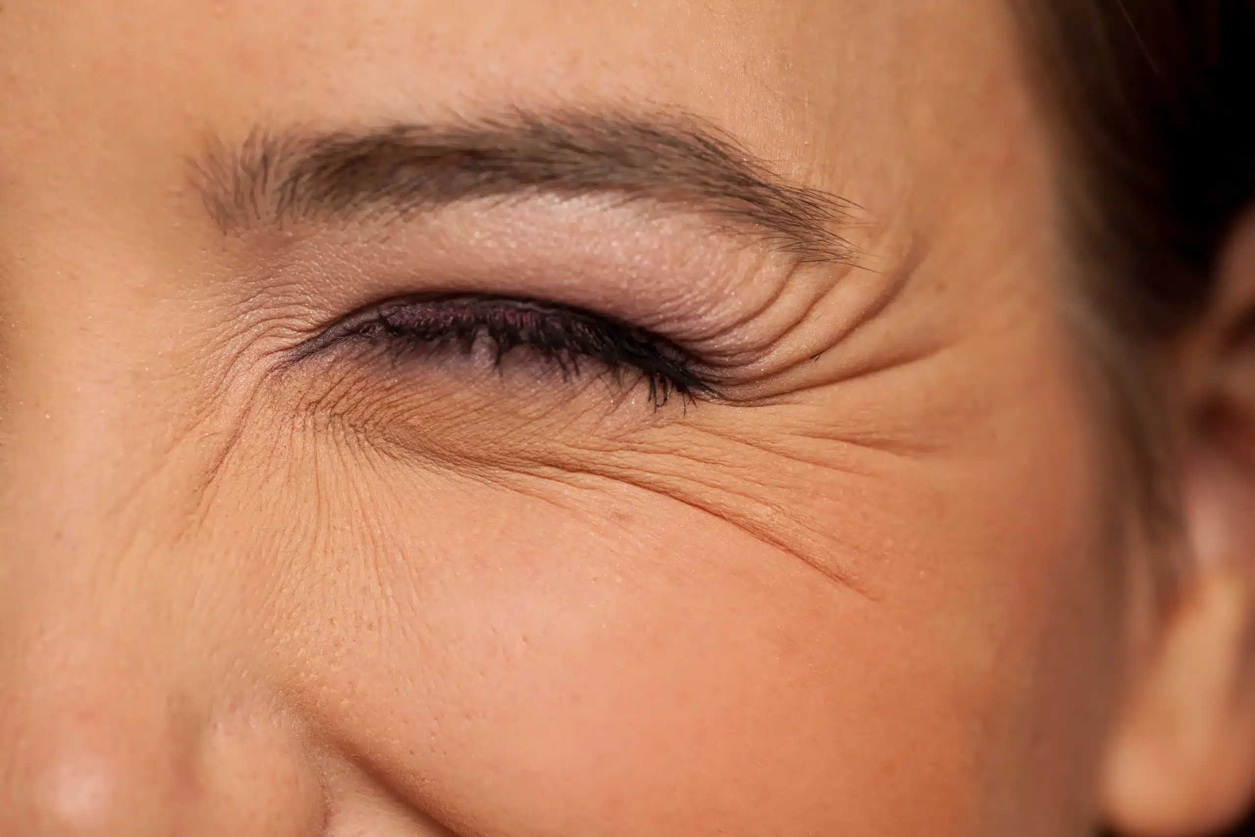 Crepey eyelids