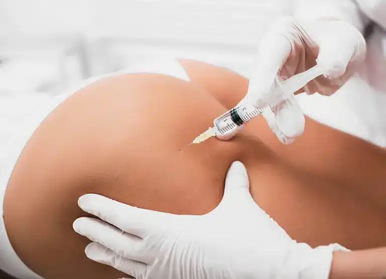 Photograph of hyaluronic acid buttock injections