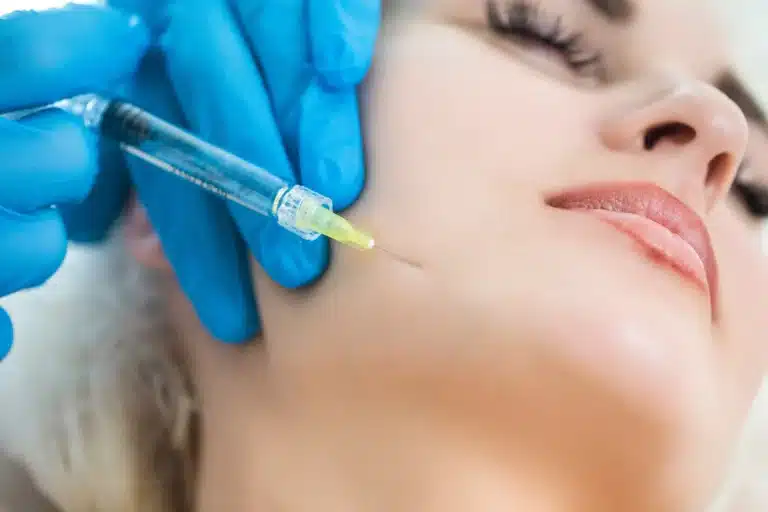 foto riempimento delle rughe della marionetta con Skinbooster
