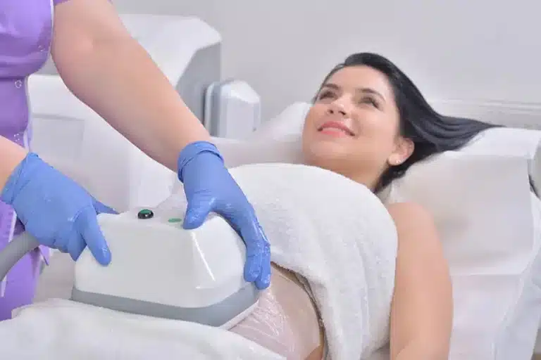 photograph of cryolipolysis for fat bulges