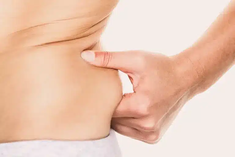 photograph of weight-gain causes