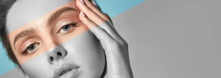 immagine laser Carbon peel