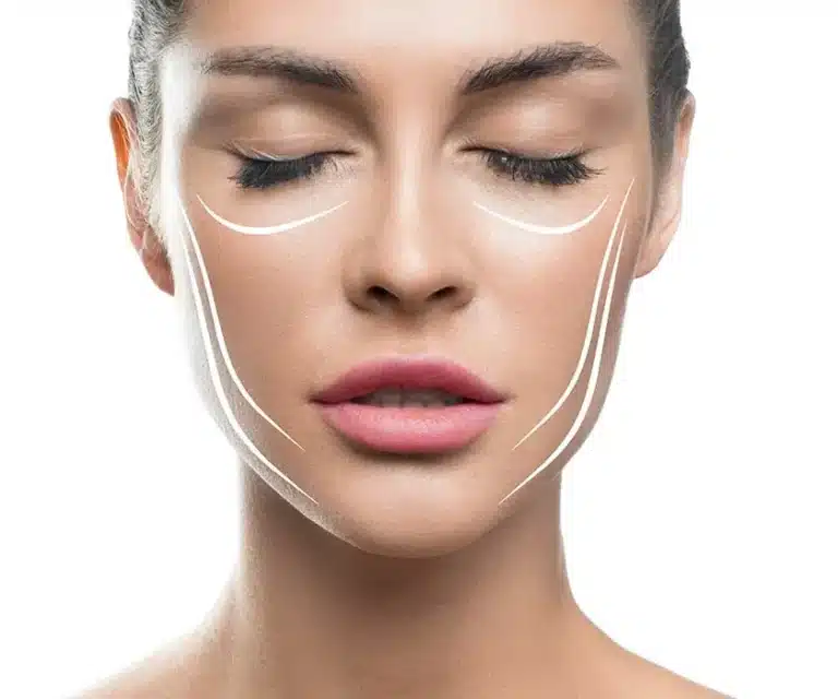 image indications Sculptra
