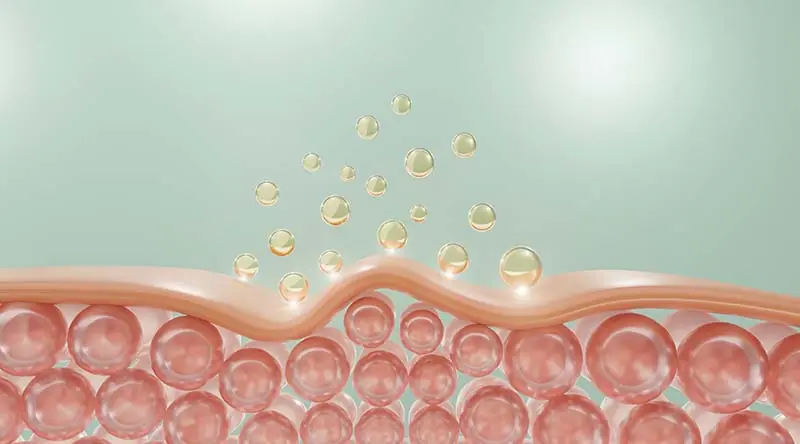 photo injections d'acide hyaluronique Genève Suisse