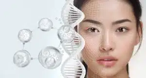 Foto laser Hollywood Spectra a Ginevra