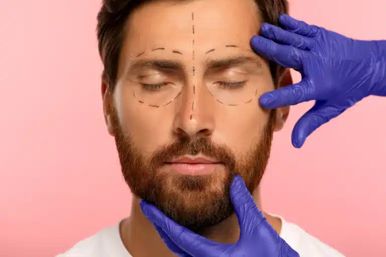 photo injections visage homme Genève