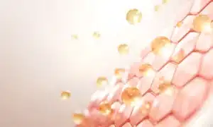 photo peel treatment for wrinkled cheeks