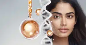 photo plumping hollow cheeks by Sculptra