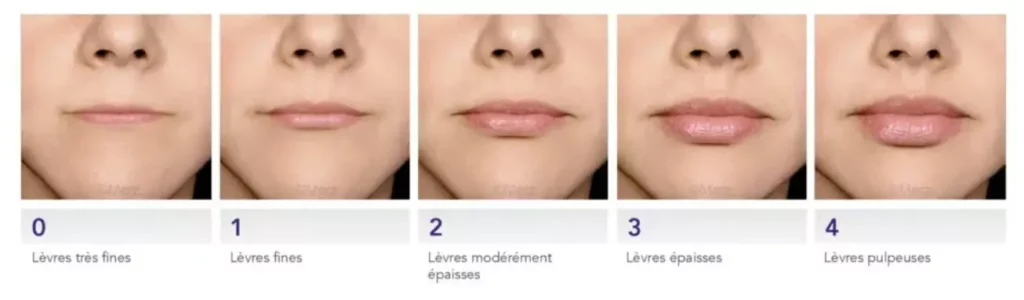 photo scale volume lips