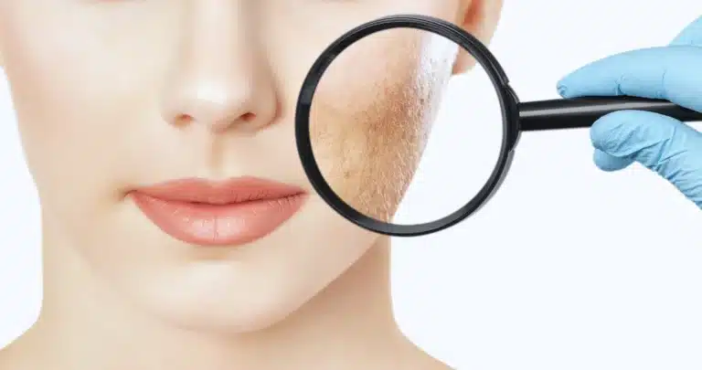 image taches visage